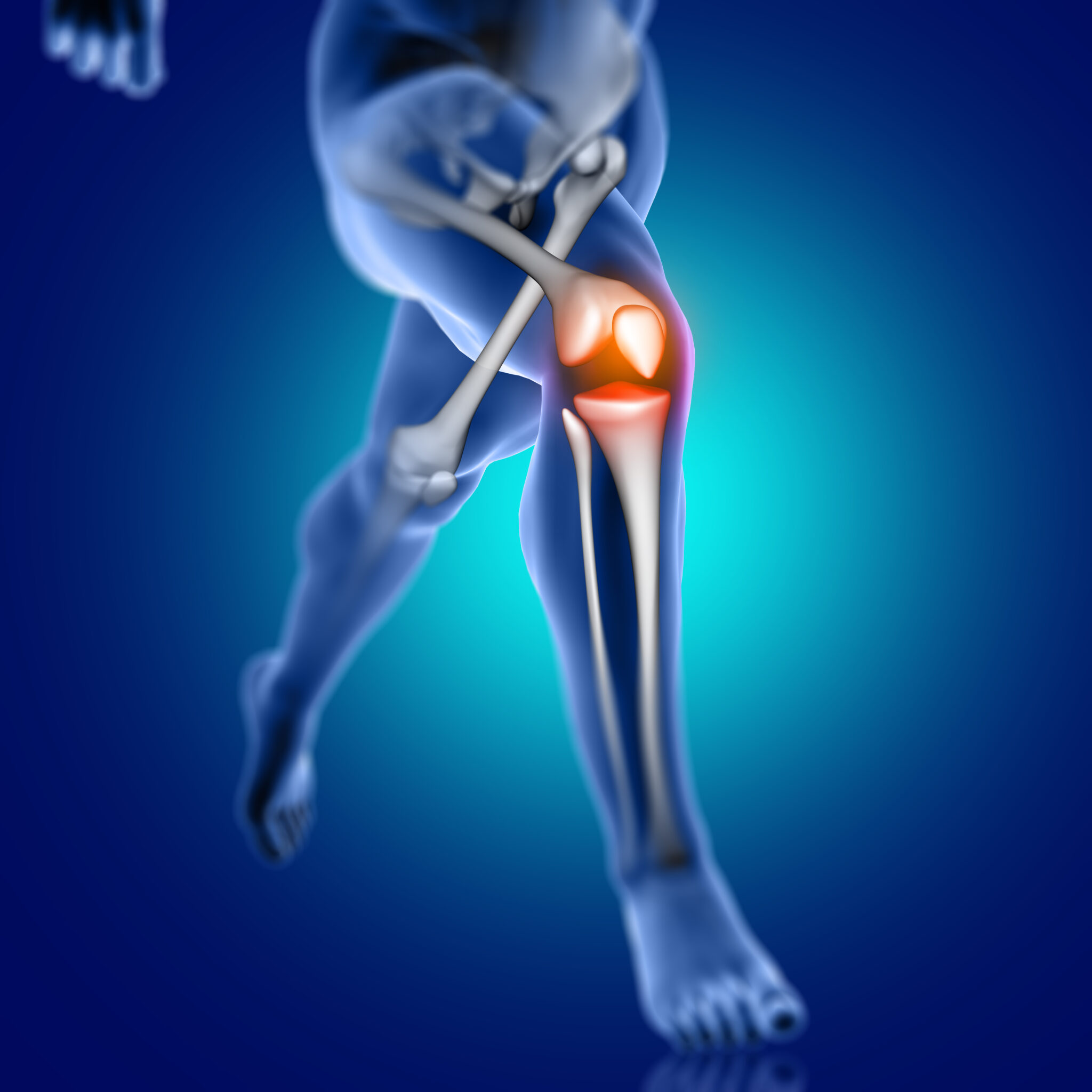 3D render of a male medical figure running with knee bone highlighted